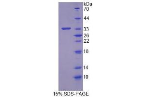 SDS-PAGE analysis of Human OSBP Protein. (OSBP 蛋白)