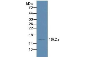 Detection of RBP5 in Human Liver Tissue using Polyclonal Antibody to Retinol Binding Protein 5, Cellular (RBP5) (Retinol Binding Protein 5 抗体  (AA 2-135))