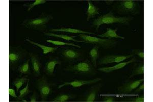 Immunofluorescence (IF) image for anti-SMAD, Mothers Against DPP Homolog 6 (SMAD6) (AA 1-496) antibody (ABIN948096)