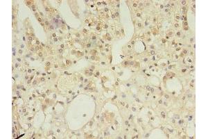 Immunohistochemistry of paraffin-embedded human adrenal gland tissue using ABIN7150209 at dilution of 1:100 (MSH6 抗体  (AA 1-400))