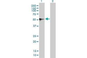 Western Blot analysis of UGT1A9 expression in transfected 293T cell line by UGT1A9 MaxPab polyclonal antibody. (UGT1A9 抗体  (AA 1-530))