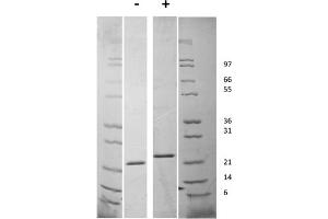 SDS-PAGE of Human Fibroblast Growth Factor-21 Recombinant Protein SDS-PAGE of Human Fibroblast Growth Factor-21 Recombinant Protein. (FGF21 蛋白)