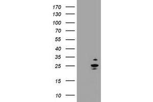 Image no. 1 for anti-RAB37, Member RAS Oncogene Family (RAB37) antibody (ABIN1500566) (RAB37 抗体)