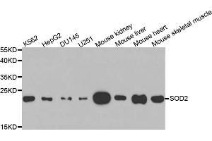 Western blot analysis of extracts of various cell lines, using SOD2 antibody. (SOD2 抗体)