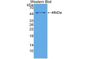 Detection of Recombinant LpPLA2, Mouse using Polyclonal Antibody to Phospholipase A2 Group VII (LpPLA2) (PLA2G7 抗体  (AA 22-440))