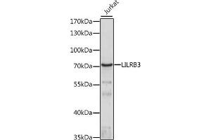 Western blot analysis of extracts of Jurkat cells, using LILRB3 antibody (ABIN7268239) at 1:1000 dilution. (LILRB3 抗体  (AA 400-500))