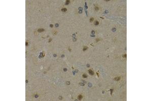 Immunohistochemistry of paraffin-embedded rat brain using MAX antibody at dilution of 1:200 (400x lens). (MAX 抗体)