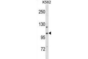 Western Blotting (WB) image for anti-Coiled-Coil and C2 Domain Containing 1A (CC2D1A) antibody (ABIN2998622)