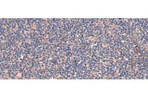 Immunohistochemistry of paraffin-embedded Human tonsil tissue using GALK2 Polyclonal Antibody at dilution of 1:95(x200) (GALK2 抗体)
