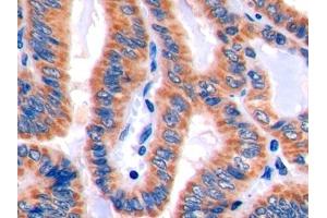 Immunohistochemistry (IHC) image for anti-Programmed Cell Death 1 Ligand 2 (PDCD1LG2) (AA 33-236) antibody (ABIN7440452)