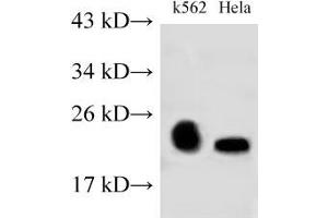 Western Blot analysis of K562 and Hela cells using RAB9A Polyclonal Antibody at dilution of 1:500 (RAB9A 抗体)