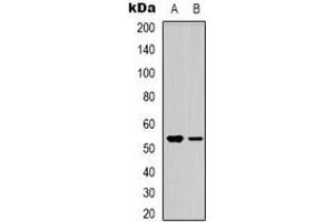 Western blot analysis of BMP3A expression in HEK293T (A), Jurkat (B) whole cell lysates. (BMP3 抗体  (C-Term))