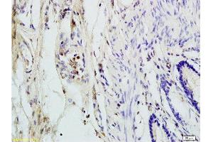 Immunohistochemistry (Paraffin-embedded Sections) (IHC (p)) image for anti-Acidic (Leucine-Rich) Nuclear phosphoprotein 32 Family, Member C (ANP32C) (AA 81-180) antibody (ABIN759941)