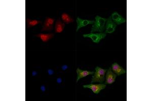 ABIN6266015 and ABIN6278800 staining Hela cells by IF/ICC. (MLL4 抗体  (C-Term))