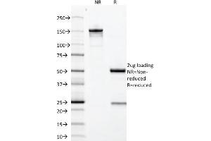 SDS-PAGE Analysis Purified Growth Hormone Mouse Monoclonal Antibody (GH/1371). (Growth Hormone 1 抗体  (AA 58-187))