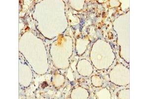 Immunohistochemistry of paraffin-embedded human thyroid tissue using ABIN7151346 at dilution of 1:100 (EML2 抗体  (AA 1-418))