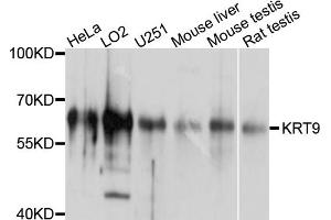 Western blot analysis of extracts of various cell lines, using KRT9 antibody. (KRT9 抗体)