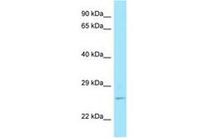 Image no. 1 for anti-RAB11A, Member RAS Oncogene Family (RAB11A) (C-Term) antibody (ABIN6748423) (RAB11A 抗体  (C-Term))