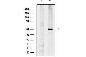anti-Dynactin 2 (p50) (DCTN2) (C-Term) antibody