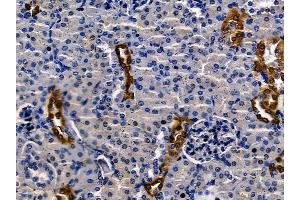ABIN7094586 and ABIN7098635 at 1/100 staining mouse kidney tissue by IHC-P. (BCL9 抗体  (C-Term))