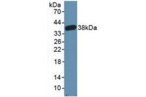 Western blot analysis of recombinant Mouse CARD9. (CARD9 抗体  (AA 274-530))