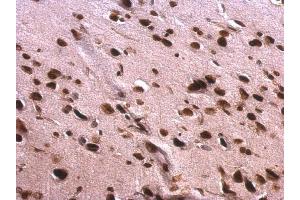 IHC-P Image Scaffold attachment factor B1 antibody detects Scaffold attachment factor B1 protein at nucleus on rat fore brain by immunohistochemical analysis. (SAFB 抗体)