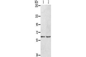 Gel: 6 % SDS-PAGE, Lysate: 40 μg, Lane 1-2: Hepg2 cells, HT29 cells, Primary antibody: ABIN7129957(KCNH6 Antibody) at dilution 1/400, Secondary antibody: Goat anti rabbit IgG at 1/8000 dilution, Exposure time: 30 seconds