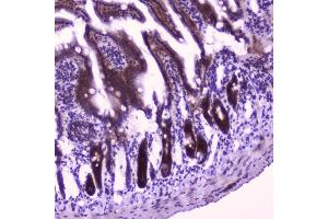 IHC analysis of FLIP using anti-FLIP antibody (ABIN5693075). (FLIP 抗体  (AA 1-376))