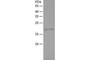 Western Blotting (WB) image for Tumor Necrosis Factor Receptor Superfamily, Member 1B (TNFRSF1B) (AA 23-206) protein (His tag) (ABIN7125554)