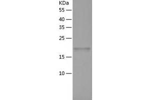 Western Blotting (WB) image for Tumor Necrosis Factor Receptor Superfamily, Member 1B (TNFRSF1B) (AA 23-206) protein (His tag) (ABIN7125554) (TNFRSF1B Protein (AA 23-206) (His tag))