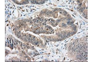 Immunohistochemical staining of paraffin-embedded Human Kidney tissue using anti-IGF2BP2 mouse monoclonal antibody. (IGF2BP2 抗体)