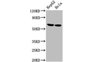 Western Blot Positive WB detected in: HepG2 whole cell lysate, Hela whole cell lysate All lanes: CKAP4 antibody at 2. (CKAP4 抗体  (AA 260-394))