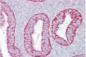 Immunohistochemistry with Uterus tissue at an antibody concentration of 5µg/ml using anti-PDGFB antibody (ARP58509_P050) (PDGFB 抗体  (N-Term))