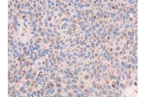 Immunohistochemistry (IHC) image for anti-Enoyl Coenzyme A Hydratase 1, Peroxisomal (ECH1) (AA 1-328) antibody (ABIN7443788)