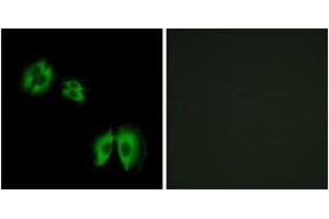 Immunofluorescence analysis of A549 cells, using B3GALT2 Antibody. (B3GALT2 抗体  (AA 373-422))
