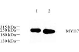 Western blot analysis of MYH7 (ABIN7075622),at dilution of 1: 500,Lane 1: Mouse heart tissue lysate,Lane 2: Rat muscle tissue lysate (Slow Skeletal Myosin Heavy Chain 抗体)