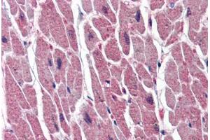 anti-Uracil-DNA Glycosylase (UNG) (AA 1-313) antibody