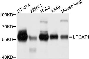 Western blot analysis of extracts of various cell lines, using LPCAT1 antibody. (LPCAT1 抗体)