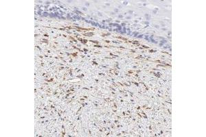 Immunohistochemical staining of human esophagus with SPARC polyclonal antibody  shows distinct positivity in fibroblasts. (SPARC 抗体)
