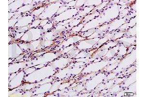 Immunohistochemistry (IHC) image for anti-Sodium Channel, Nonvoltage-Gated 1, gamma (SCNN1G) (AA 188-290) antibody (ABIN706076)
