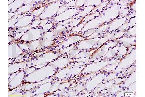 Formalin-fixed and paraffin embedded rat kidney tissue labeled with Anti-ENaCg/? (SCNN1G 抗体  (AA 188-290))