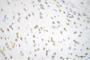 anti-Ankyrin Repeat-Containing Protein (EHMT2) antibody