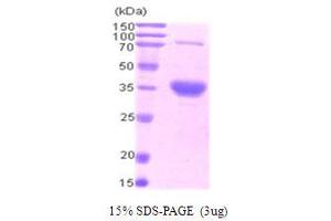 SDS-PAGE (SDS) image for Baculoviral IAP Repeat-Containing 7 (BIRC7) (AA 1-298) protein (His tag) (ABIN667709) (BIRC7 Protein (AA 1-298) (His tag))