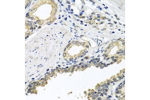 Immunohistochemistry of paraffin-embedded human prostate using STXBP2 antibody at dilution of 1:100 (x40 lens). (STXBP2 抗体)