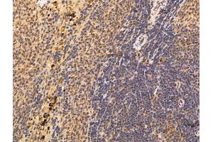 ABIN7094583 and ABIN7098632 at 1/100 staining Rat spleen tissue by IHC-P. (Septin 4 抗体  (Internal Region))