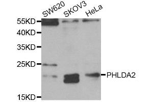 Western Blotting (WB) image for anti-Pleckstrin Homology-Like Domain, Family A, Member 2 (PHLDA2) antibody (ABIN1882371) (PHLDA2 抗体)