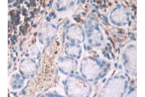 Detection of FLNa in Human Stomach Tissue using Polyclonal Antibody to Filamin A Alpha (FLNa) (Filamin A 抗体  (AA 2-274))