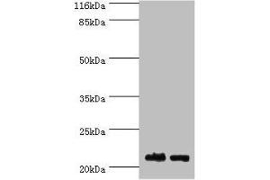 Western blot All lanes: NABP1 antibody at 2 μg/mL Lane 1: Hela whole cell lysate Lane 2: Jurkat whole cell lysate Secondary Goat polyclonal to rabbit IgG at 1/10000 dilution Predicted band size: 23, 14, 15 kDa Observed band size: 23 kDa (OBFC2A 抗体  (AA 1-204))