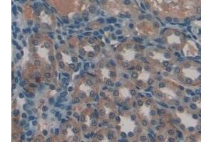 Immunohistochemistry (IHC) image for anti-Gremlin 1 (GREM1) (AA 26-184) antibody (ABIN7434692)