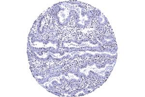Uterus endometrium In this sample of endometrium nucleolin staining is particularly prominent in the nucleoli of epithelial and stromal cells (Recombinant Nucleolin 抗体)